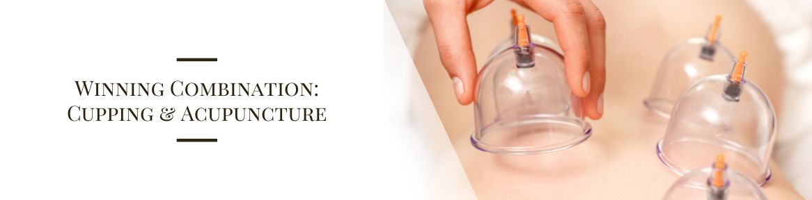 Winning Combination: Cupping & Acupuncture